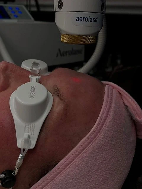 Close-up of the Aerolase handpiece during a treatment, a white laser eye shield over the client’s eye, Aerolase unit in the background