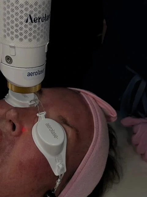 An Aerolase treatment in progress: the handpiece above a client’s face, white laser eye shields in place, pink headband